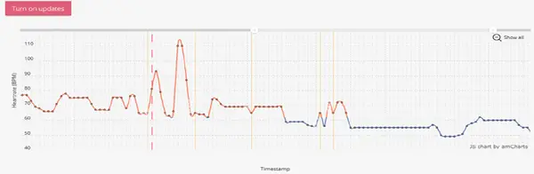 Figure 4. Fragment of the dashboard page of the web application. Shown is a graph of a user’s heart rate (BPM versus time), as well as an option to turn on live updates (showing only the latest 5 pulse measurements). Values in the plot above the measured mean heart rate are coloured orange, and values below the mean heart rate are coloured blue.